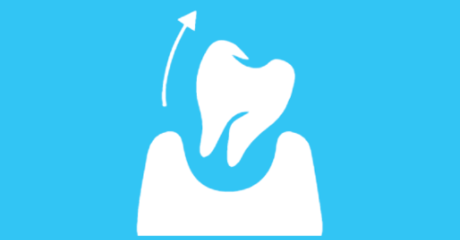 Tooth Extraction