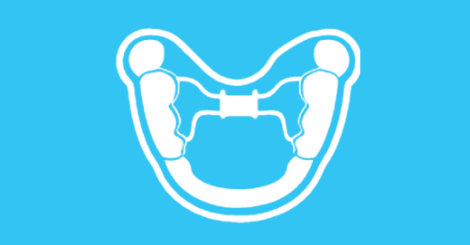 Surgically Assisted Rapid Palatal Expansion